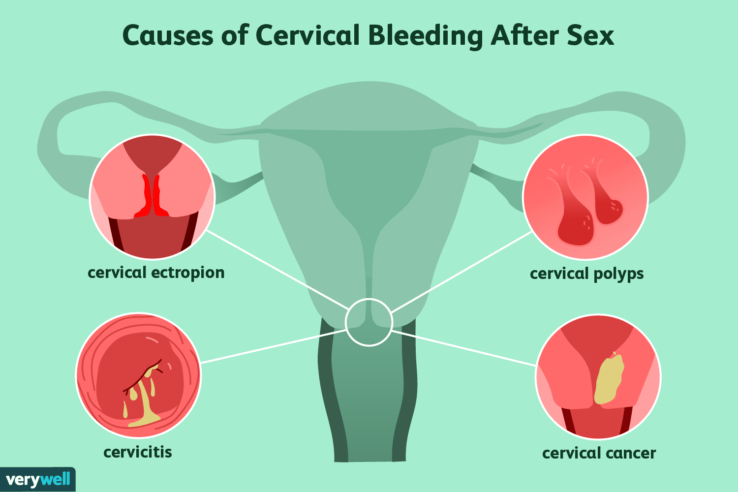Why am I Bleeding After Using a Toy: Causes & Quick Solutions